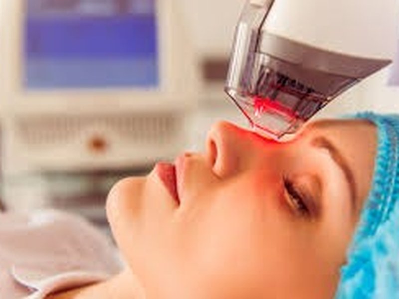 Light-based dermatology treatment equipment