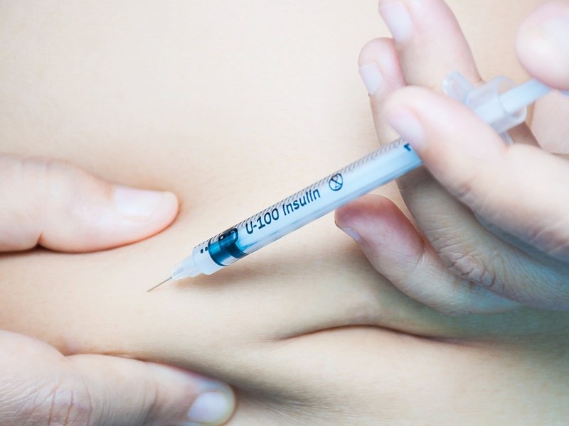 Body treatment injection procedure